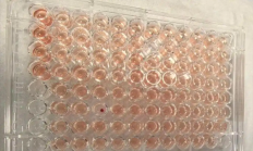 
        		比“熊猫血”罕见百倍！广东顺德发现一例“钻石血” !	