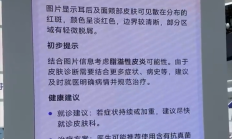 博主坦言美国看病太贵太麻烦:想把中国的AI医生带回去